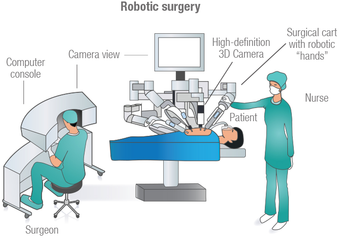 innovations-explained-what-are-surgical-robots-giddyup